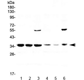 AP-1 / JUND Antibody