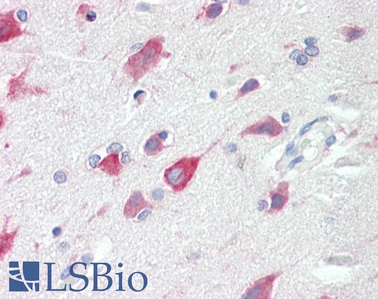 IHC-plus™ NARG1 / NAA15 Antibody (aa221-270)
