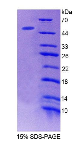 Mouse ACP6 Protein (Recombinant His-T7, N-terminus)
