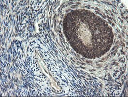 P3H1 / LEPRE1 Antibody (clone OTI1H3)