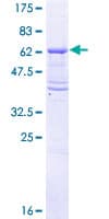 Human TGFBR2 Protein (Recombinant GST, N-terminus)