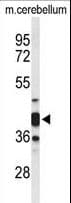 CYTH3 / GRP1 Antibody (aa371-400)