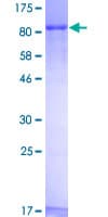 Human Zyxin Protein (Recombinant GST)
