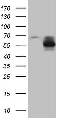 MMP3 Antibody (aa246-477, clone OTI3C6)