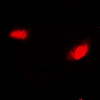 SIRT7 / Sirtuin 7 Antibody
