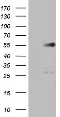 GATA3 Antibody (aa155-443, clone OTI8E11)