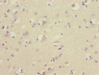 FOXN2 Antibody