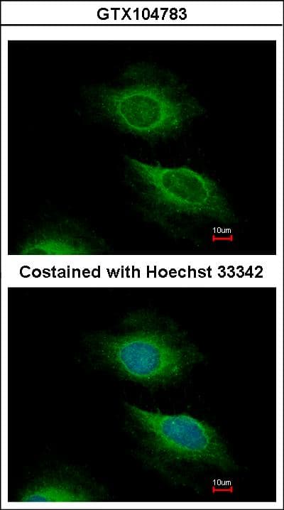 Polyclonal Rabbit anti-Human ARF5 Antibody (aa49-180, WB)