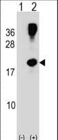 Polyclonal Rabbit anti-Human RHOG / ARHG Antibody (aa99-128, WB)