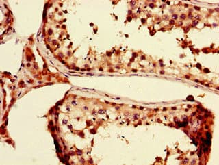 Polyclonal Rabbit anti-Human PRDM4 Antibody