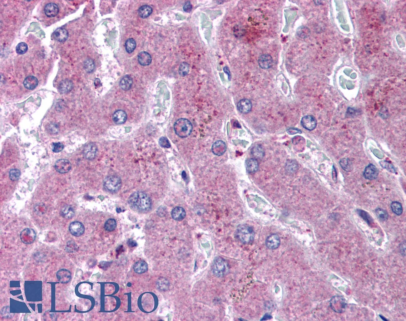 IHC-plus™ Polyclonal Rabbit anti-Human NOTCH2 Antibody (N-Terminus, IHC, WB)
