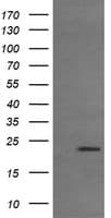 TCL / RHOJ Antibody (clone OTI2C9)