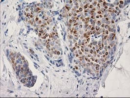 OSGEP Antibody (clone OTI8B3)