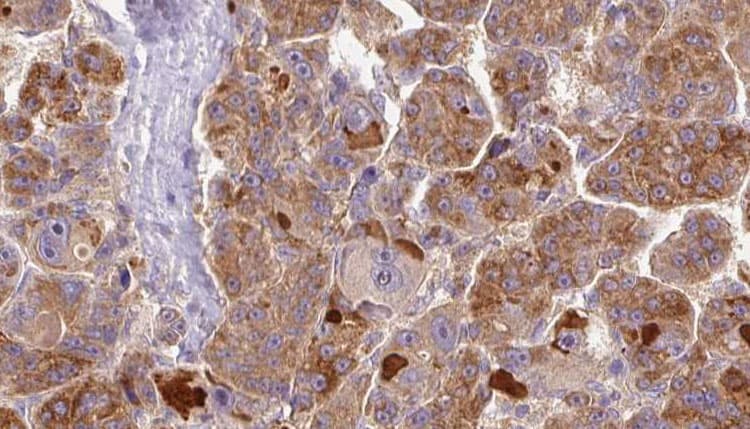 GPR146 Antibody