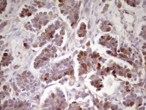 ECT2 Antibody (aa175-438, clone OTI2D9)