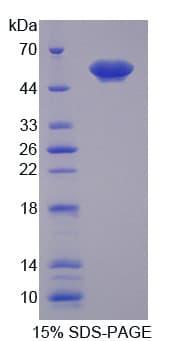 Human ANXA11 / Annexin XI Protein (Recombinant His)