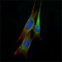 ETS1 / ETS-1 Antibody (clone 8A8)
