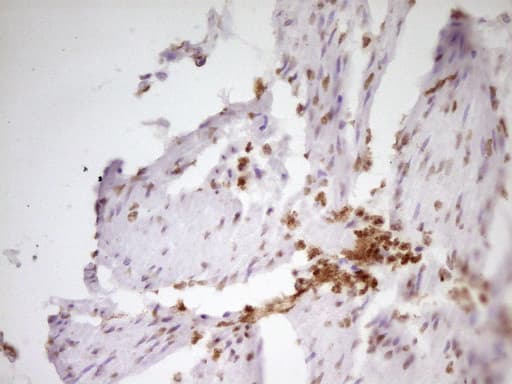 Monoclonal Mouse anti-Human SP110 Antibody (clone OTI4C1, aa232-521, IHC, WB)