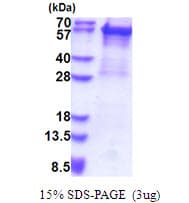 Human KRT5 / CK5 / Cytokeratin 5 Protein (Recombinant His)