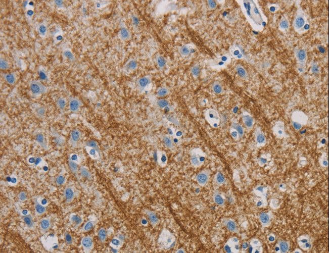 ABL1 / c-ABL Antibody