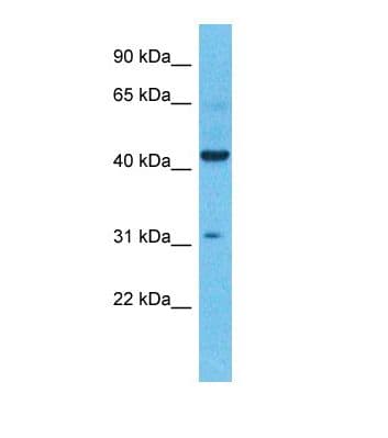KCNK4 / TRAAK Antibody (aa43-92)