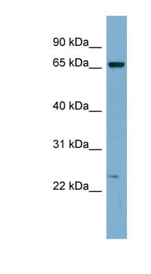 ZNF572 Antibody (C-Terminus)