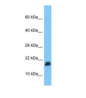 Polyclonal Rabbit anti-Human TEFM Antibody (aa21-70, WB)