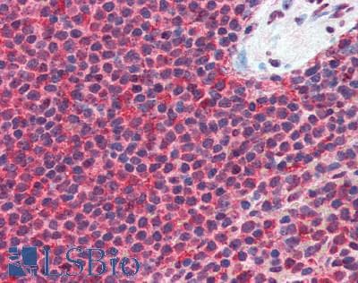 IHC-plus™ TPI1 / TPI Antibody