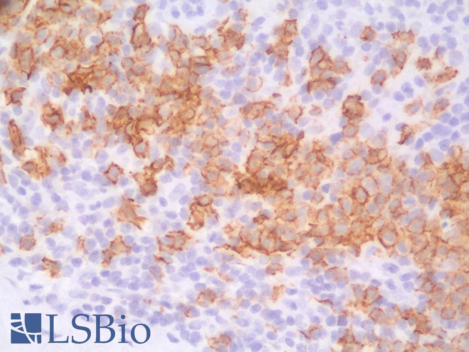PathPlus™ CD20 Antibody (clone IGEL/1497R)
