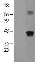 Human NKX2-1 / Thyroid-Specific TF Protein (Over-Expression Lysate Myc-DDK (Flag))
