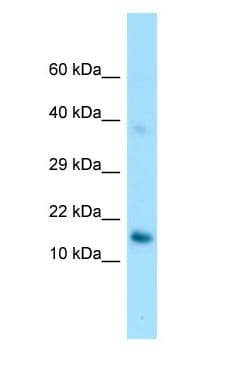Polyclonal Rabbit anti-Human GPIHBP1 Antibody (C-Terminus, WB)