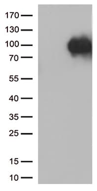 SORT1 / Sortilin Antibody (aa34-300, clone OTI3H4)