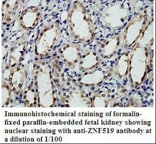 ZNF519 Antibody (aa249-532)