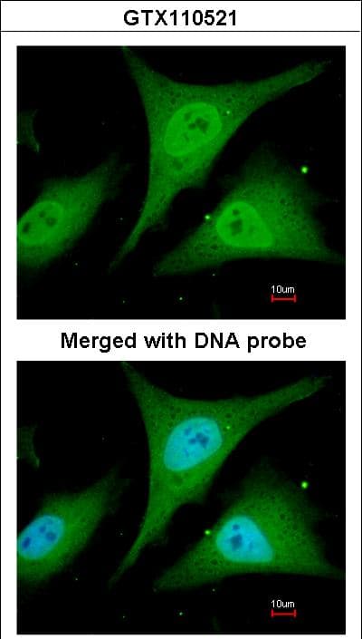 NFKBIA / IKB Alpha / IKBA Antibody (aa1-317)