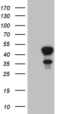 ELF3 / ESE1 Antibody (aa175-286, clone OTI3F2)