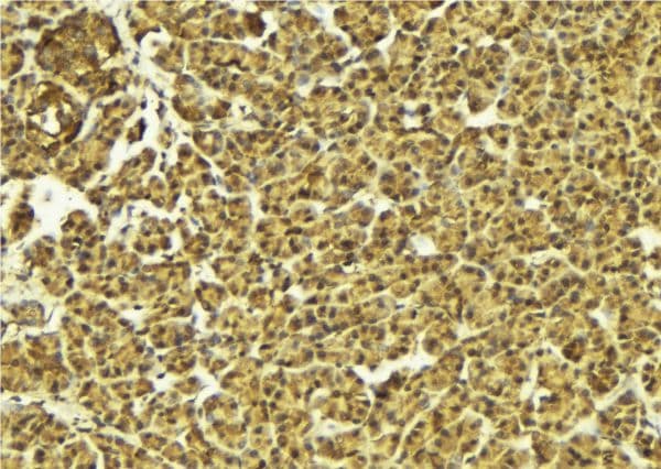 API5 Antibody