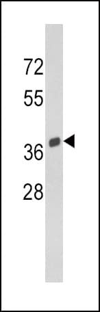 Polyclonal Rabbit anti-Human Osteonectin / SPARC Antibody (aa224-251, IHC, WB)