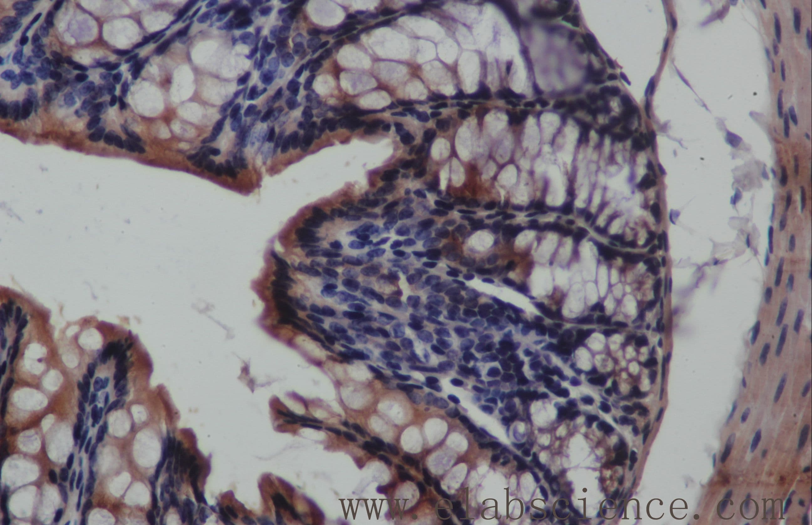 KRT19 / CK19 / Cytokeratin 19 Antibody