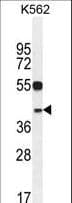 YOD1 Antibody (aa319-347)