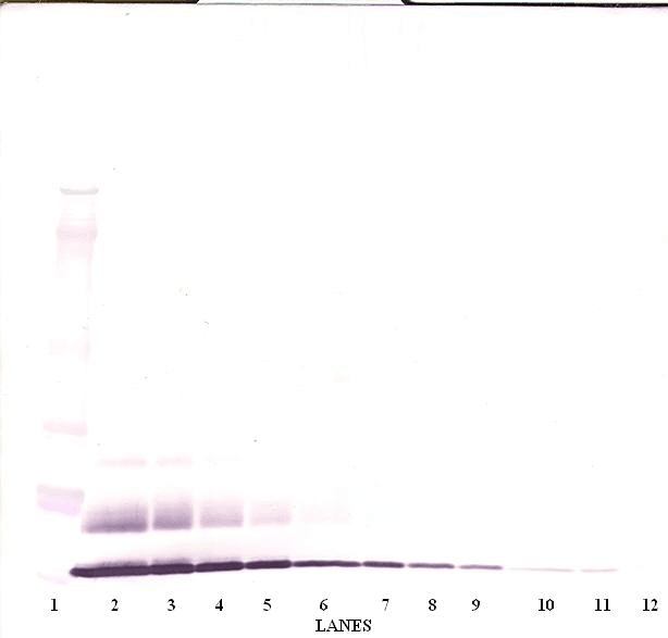 IHC-plus™ CCL8 / MCP2 Antibody