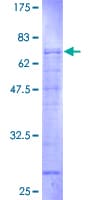 Human GOLGA2 / GM130 Protein (Recombinant GST)