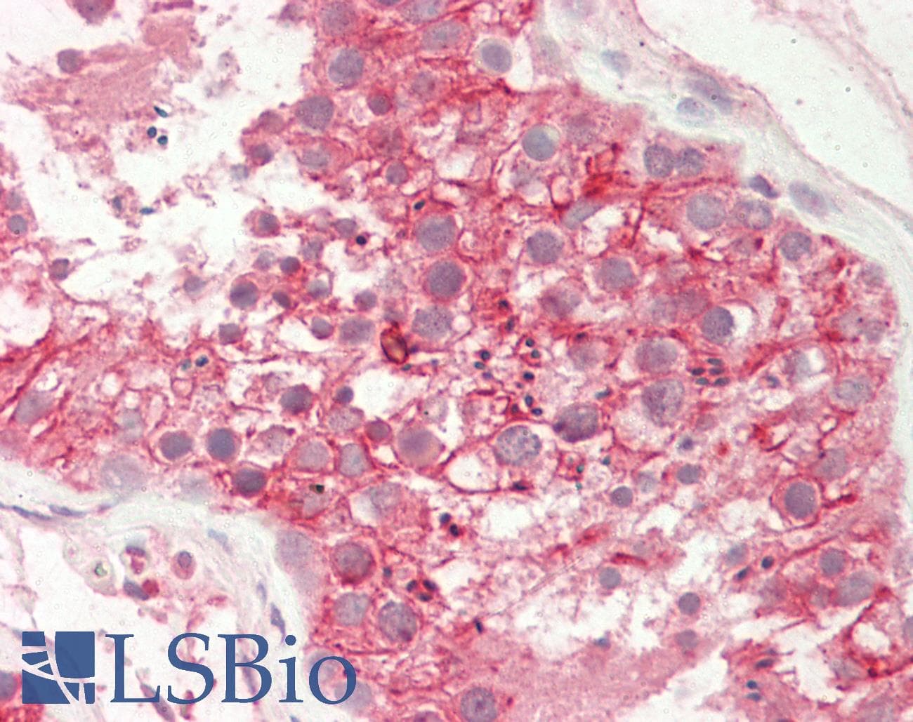 IHC-plus™ GOK / STIM1 Antibody (N-Terminus)