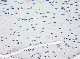 Monoclonal Mouse anti-Human ZFP36 / Tristetraprolin Antibody (clone OTI8B5, IHC, IF, WB)
