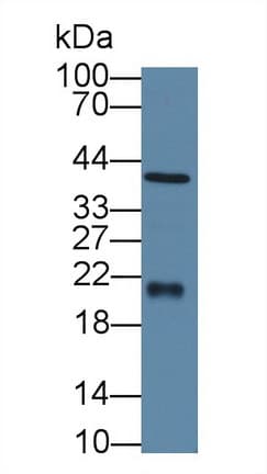FTH1 / Ferritin Heavy Chain Antibody (aa1-183)