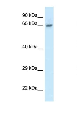 FAM161A Antibody (aa229-278)