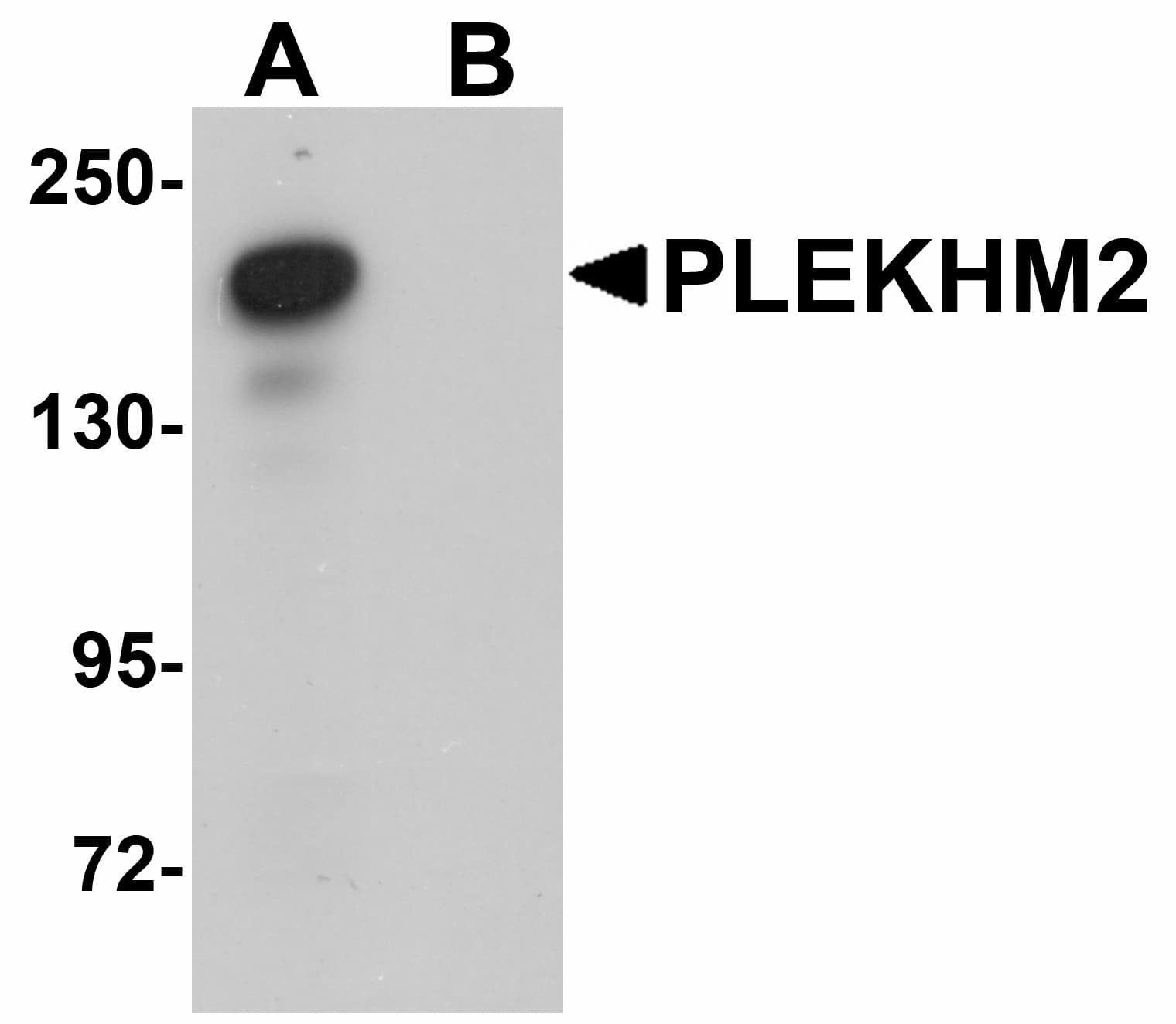IHC-plus™ Polyclonal Rabbit anti-Human PLEKHM2 / SKIP Antibody (IHC, IF, WB)