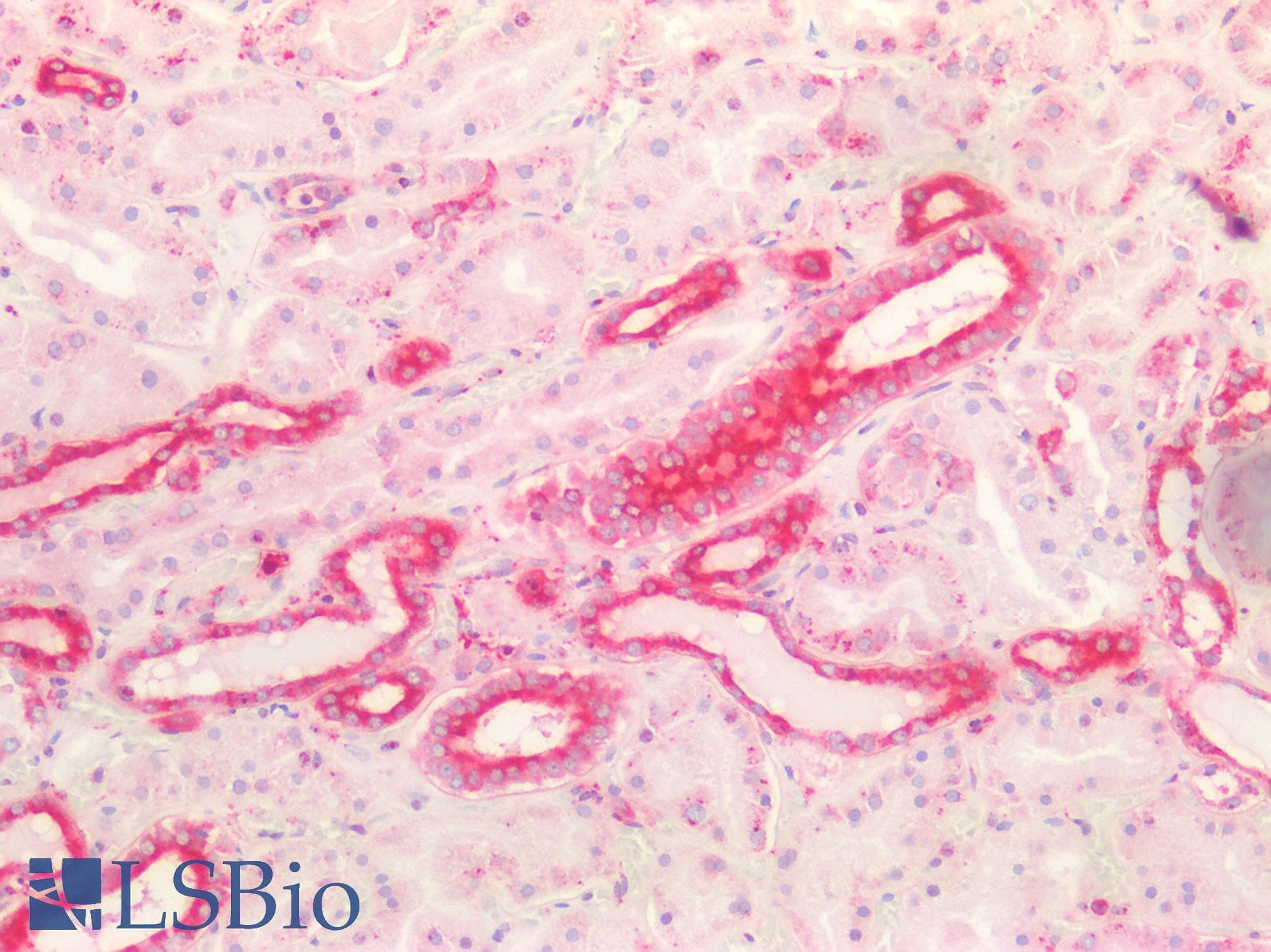 IHC-plus™ Polyclonal Rabbit anti-Human HTR2C / 5-HT2C Receptor Antibody (aa400-450, IHC, IF, WB)