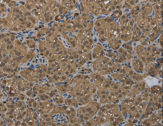 GSTP1 / GST Pi Antibody