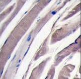 HK2 / Hexokinase 2 Antibody (aa91-121)