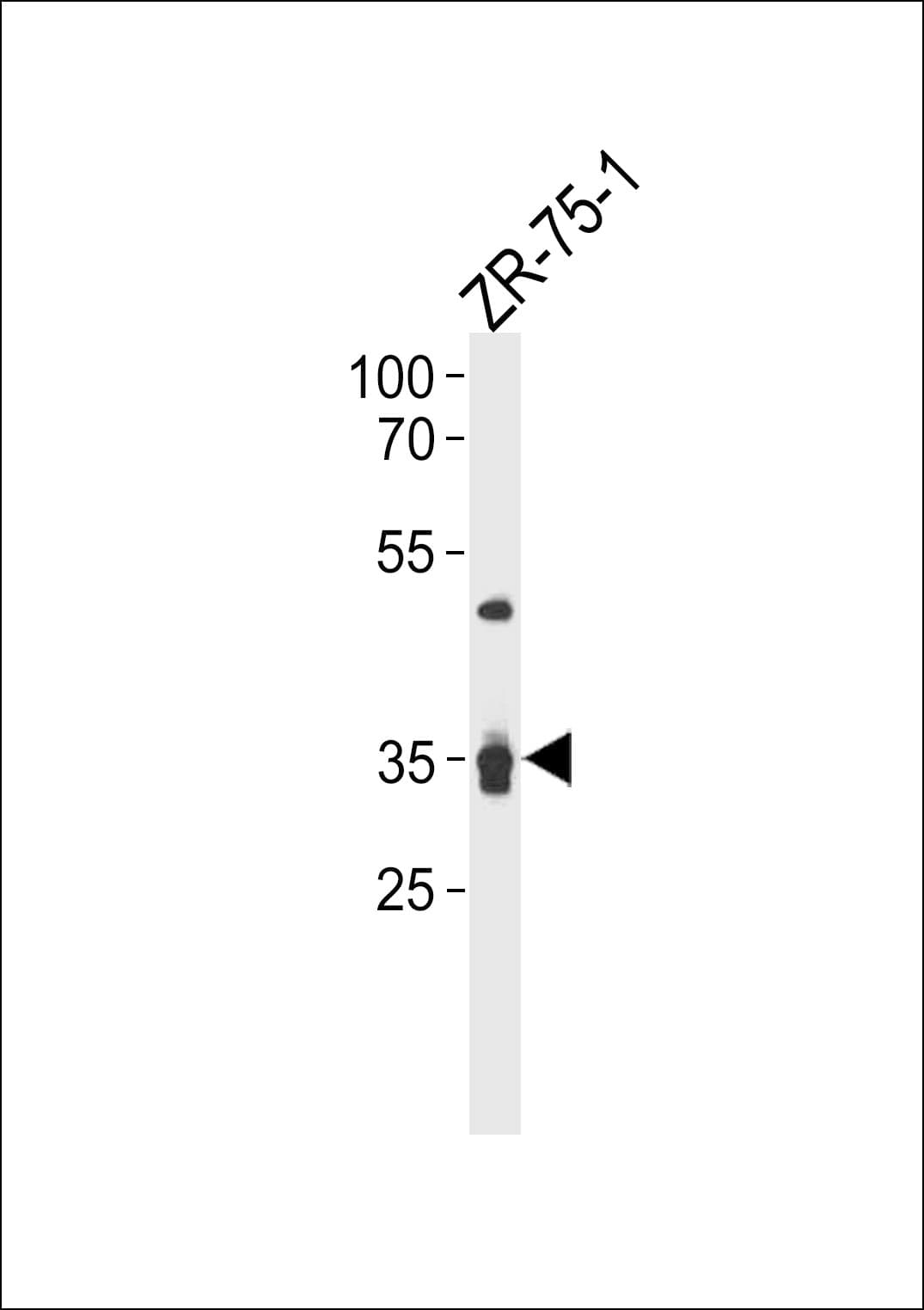 Polyclonal Rabbit anti-Human IL3RA / CD123 Antibody (aa322-348, WB)